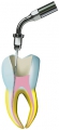 Limes endodontiques  Kent Dental 187594