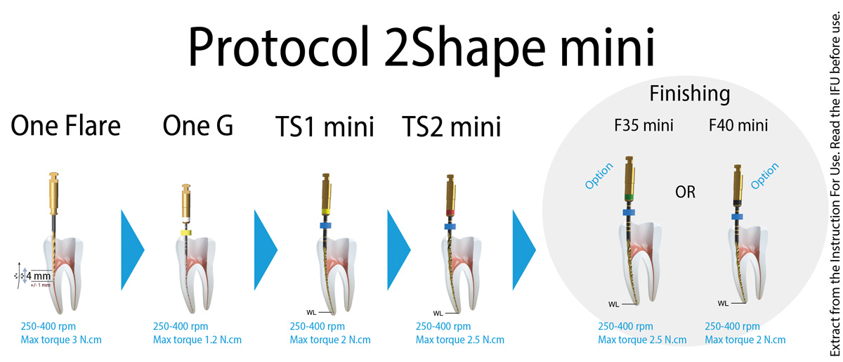 2Shape mini Le blister stérile de 5 limes Longueur 21 mm MicroMega 184426